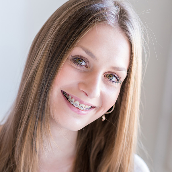 metal braces at Smithtown Orthodontics in Smithtown, NY