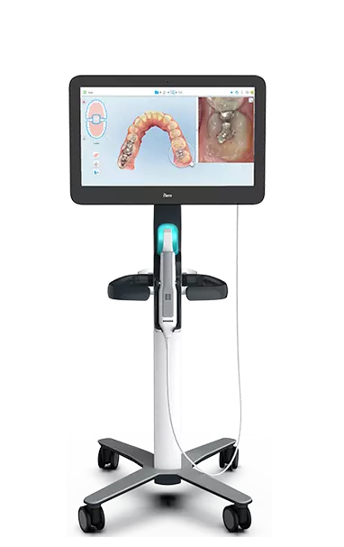 iTero™ Digital Impressions - Speed, Accuracy & Comfort Smithtown Orthodontics